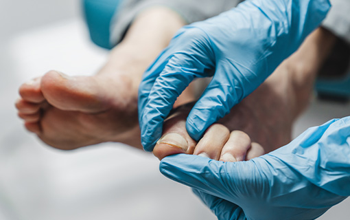Latex gloved hands examine a patient's foot.